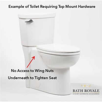 Top Mount Toggles f¨¹r Bath Royale Toilettensitze (Set von 2)