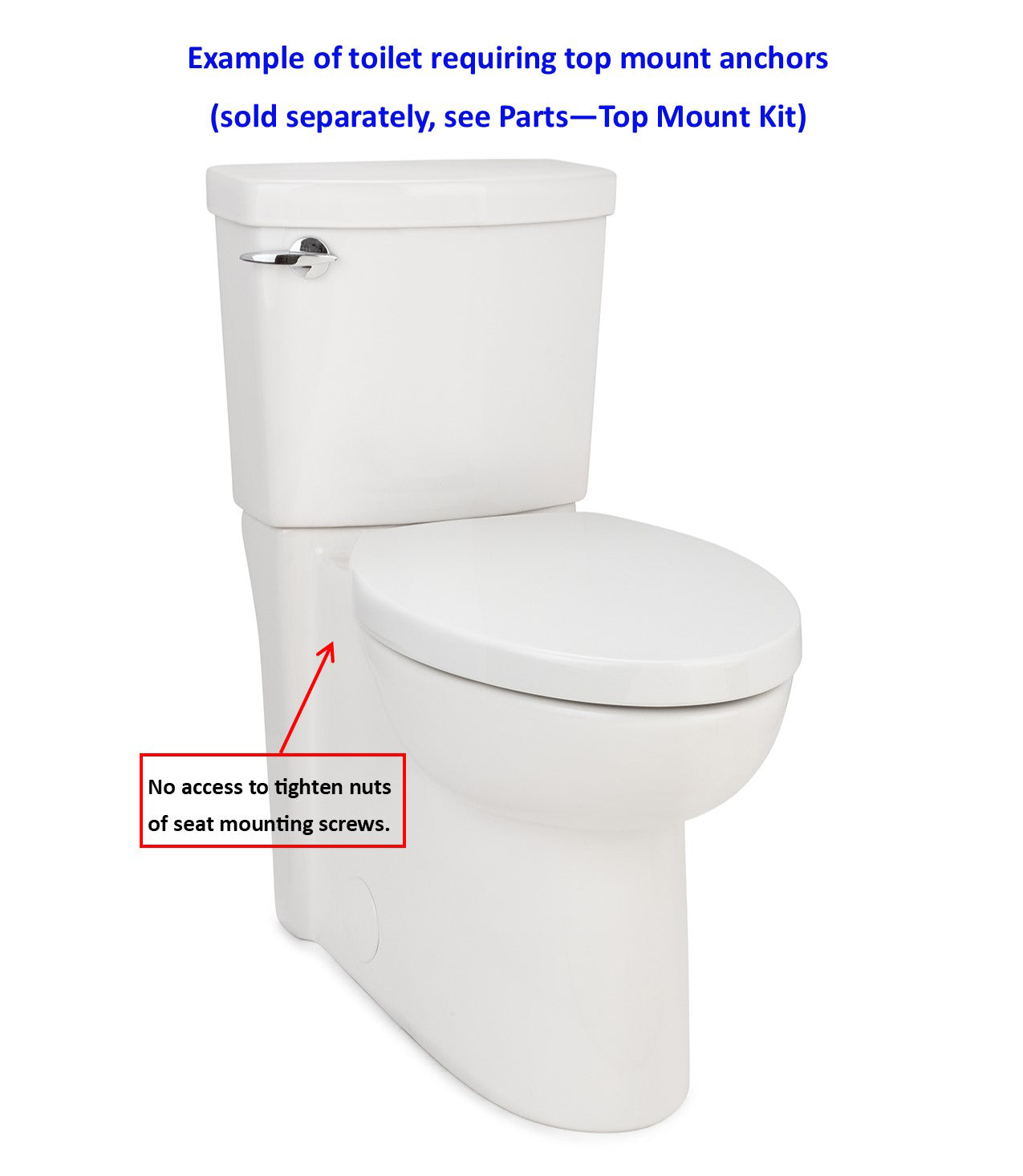 Top Mount Anker mit Edelstahlschrauben (Set von 2)