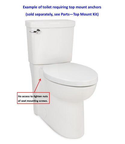 Top Mount Anker mit Edelstahlschrauben (Set von 2)